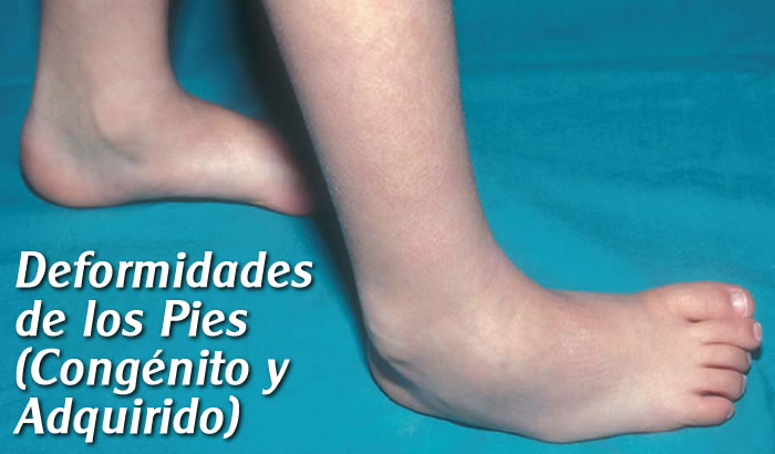 Traumatólogo Ortopedista en Toluca