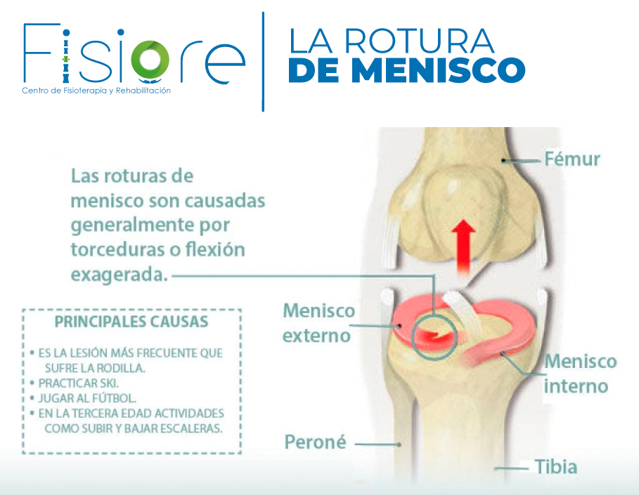 Ortopedistas en Metepec