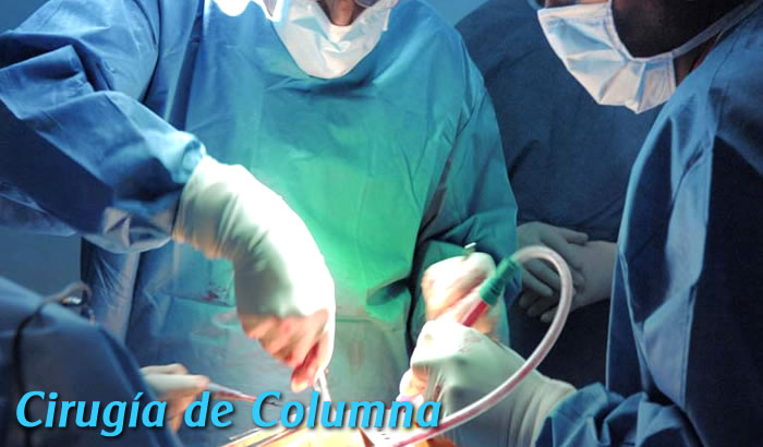 Cirugía de columna en Toluca y Metepec