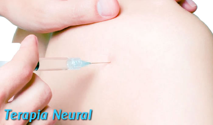 Traumatólogo en Metepec Terapia Neural